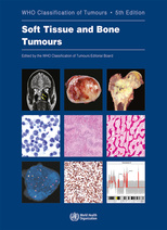 Soft Tissue and Bone Tumours Edition 5: WHO Classification of Tumours