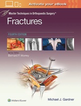 Master Techniques in Orthopaedic Surgery: Fractures, 4th Edition