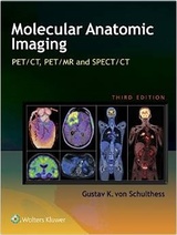 Clinical Molecular Anatomic Imaging: PET/CT, PET/MR and SPECT CT, 3e