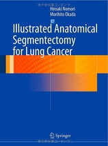 Illustrated Anatomical Segmentectomy for Lung Cancer, 1st Edition